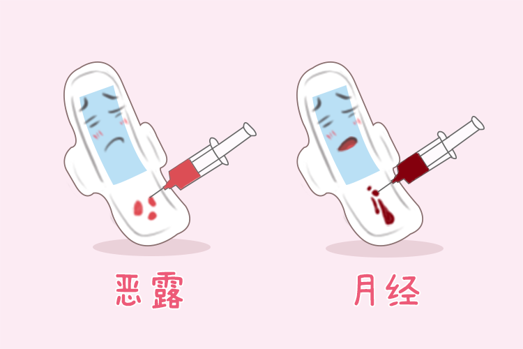 区分产后月经和恶露