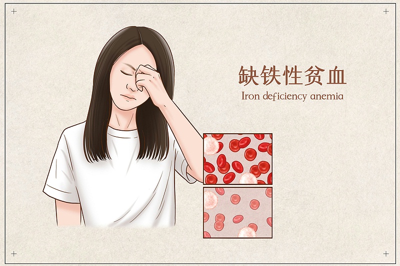 女性贫血