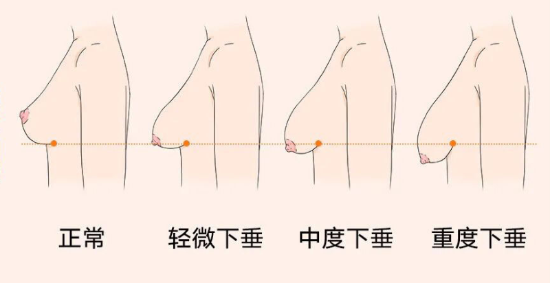 母乳喂养