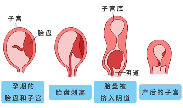 产后子宫恢复