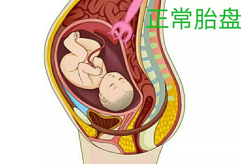正常胎盘