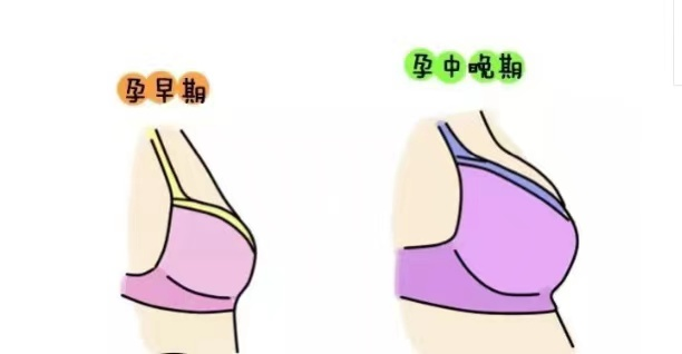 着床后乳房变化图片图片