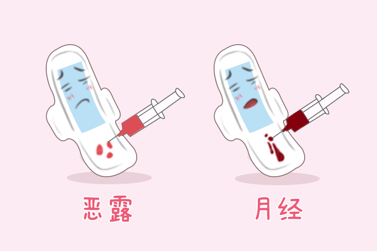 恶露和月经区别