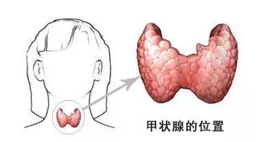 甲状腺